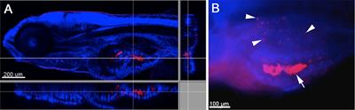 A Zebrafish Model for Chlamydia Infection with the Obligate Intracellular Pathogen Waddlia chondrophila